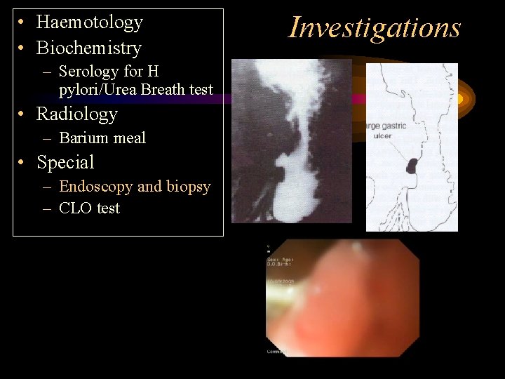  • Haemotology • Biochemistry – Serology for H pylori/Urea Breath test • Radiology