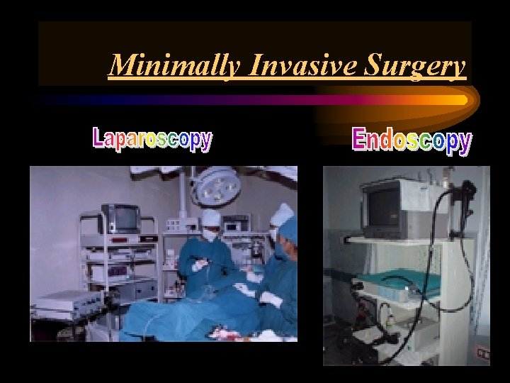 Minimally Invasive Surgery 