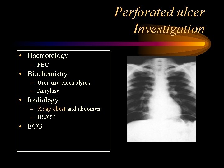 Perforated ulcer Investigation • Haemotology – FBC • Biochemistry – Urea and electrolytes –