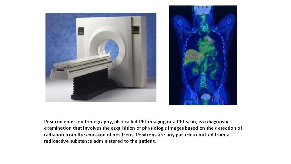 Positron emission tomography, also called PET imaging or a PET scan, is a diagnostic