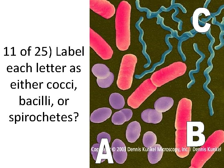 11 of 25) Label each letter as either cocci, bacilli, or spirochetes? 