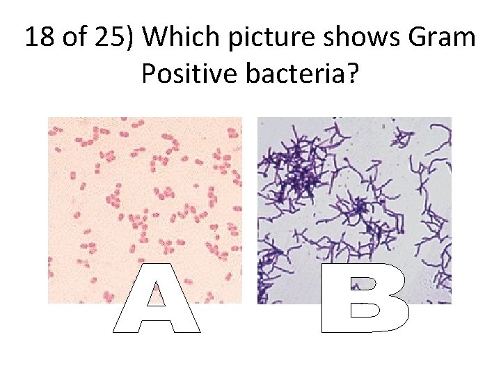 18 of 25) Which picture shows Gram Positive bacteria? 