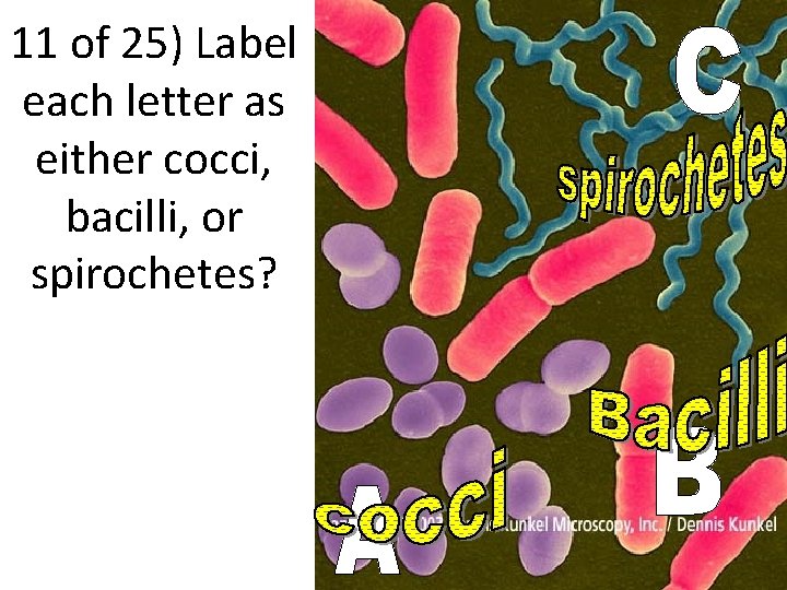 11 of 25) Label each letter as either cocci, bacilli, or spirochetes? 