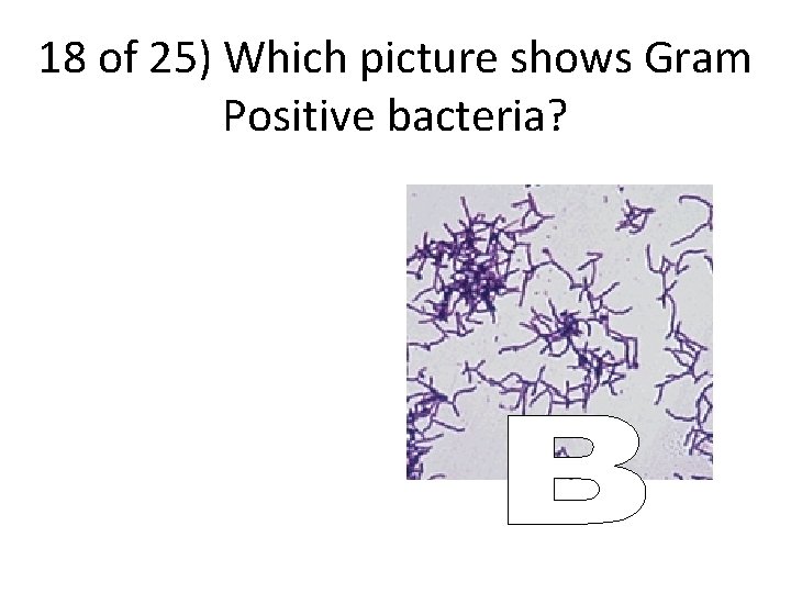 18 of 25) Which picture shows Gram Positive bacteria? 