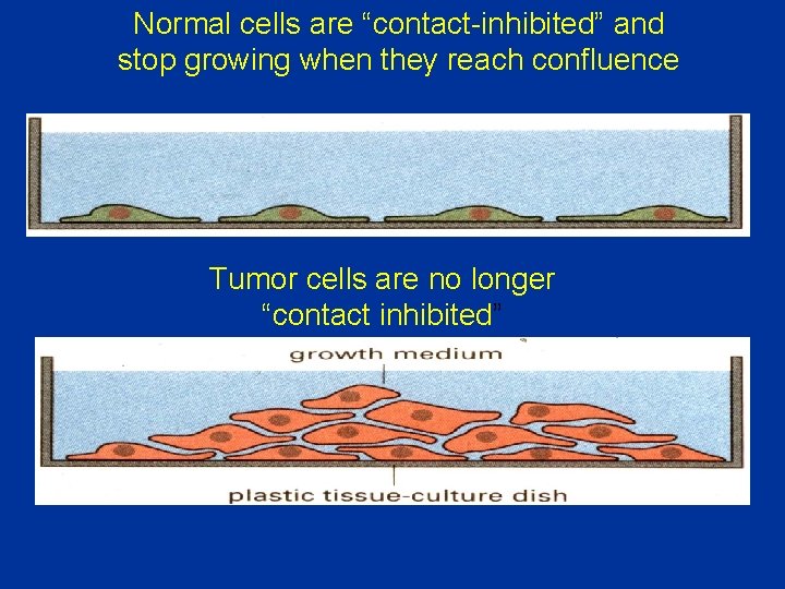 Normal cells are “contact-inhibited” and stop growing when they reach confluence Tumor cells are