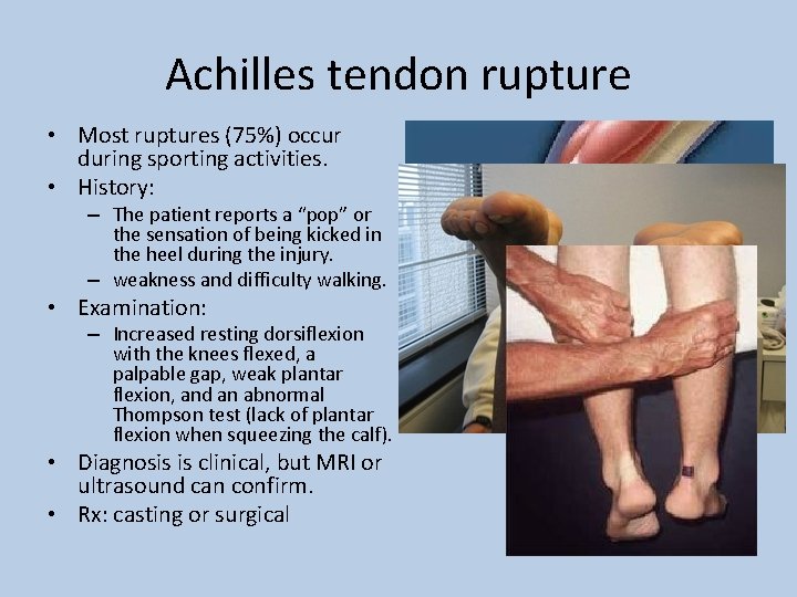Achilles tendon rupture • Most ruptures (75%) occur during sporting activities. • History: –