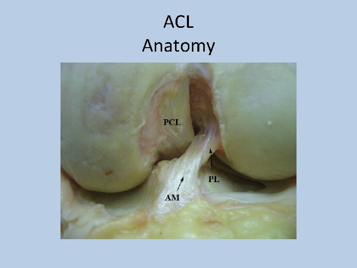 ACL Anatomy 