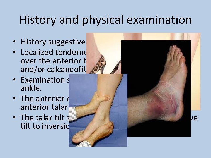 History and physical examination • History suggestive of inversion injury • Localized tenderness, swelling,