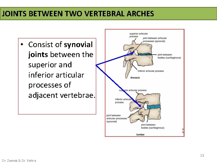 JOINTS BETWEEN TWO VERTEBRAL ARCHES • Consist of synovial joints between the superior and