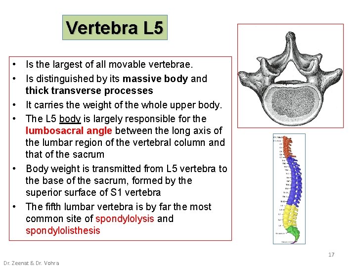 Vertebra L 5 • Is the largest of all movable vertebrae. • Is distinguished