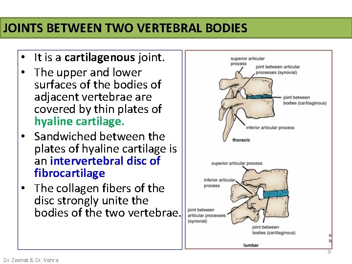 JOINTS BETWEEN TWO VERTEBRAL BODIES • It is a cartilagenous joint. • The upper