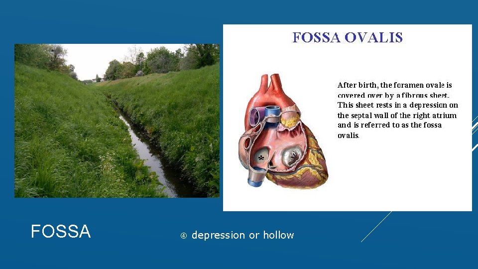 FOSSA depression or hollow 