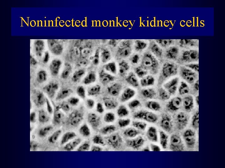 Noninfected monkey kidney cells 