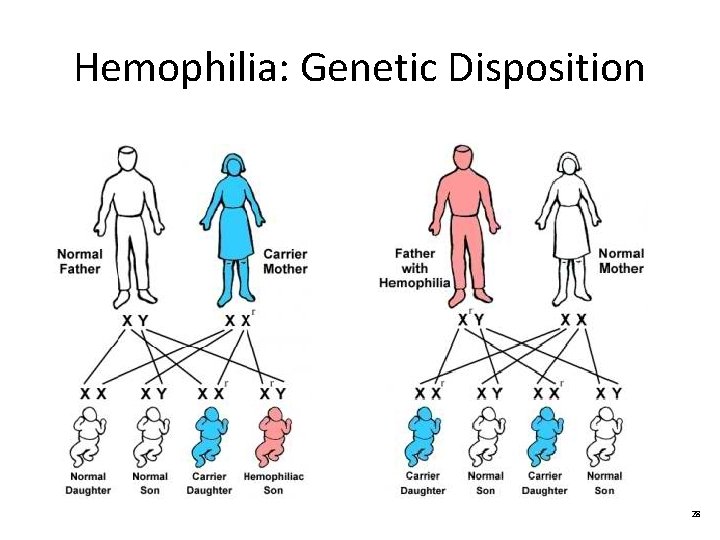 Hemophilia: Genetic Disposition 28 