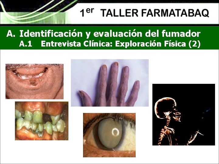 A. Identificación y evaluación del fumador A. 1 Entrevista Clínica: Exploración Física (2) 