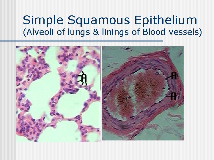 Simple Squamous Epithelium (Alveoli of lungs & linings of Blood vessels) n n 