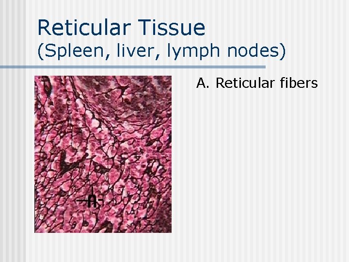 Reticular Tissue (Spleen, liver, lymph nodes) n A. Reticular fibers 