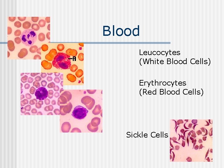 Blood n Leucocytes (White Blood Cells) Erythrocytes (Red Blood Cells) Sickle Cells 