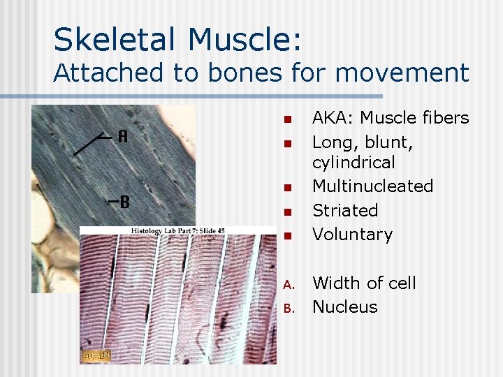 Skeletal Muscle: Attached to bones for movement n n n A. B. AKA: Muscle