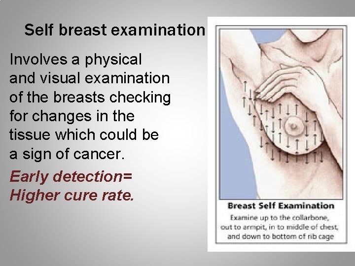 Self breast examination Involves a physical and visual examination of the breasts checking for