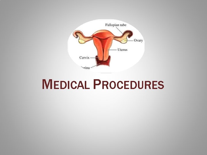 MEDICAL PROCEDURES 