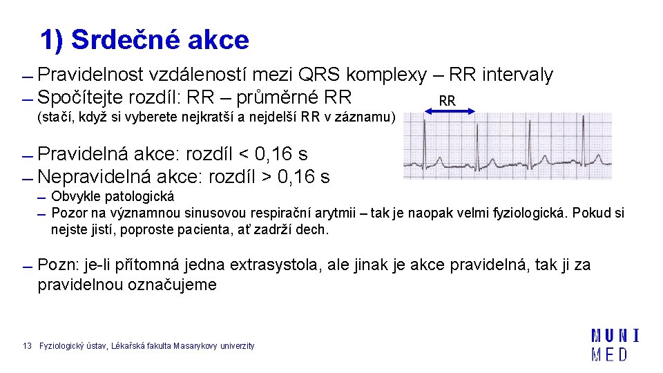 1) Srdečné akce Pravidelnost vzdáleností mezi QRS komplexy – RR intervaly Spočítejte rozdíl: RR