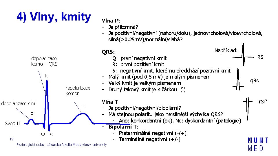 4) Vlny, kmity depolarizace komor - QRS R repolarizace komor depolarizace síní T P