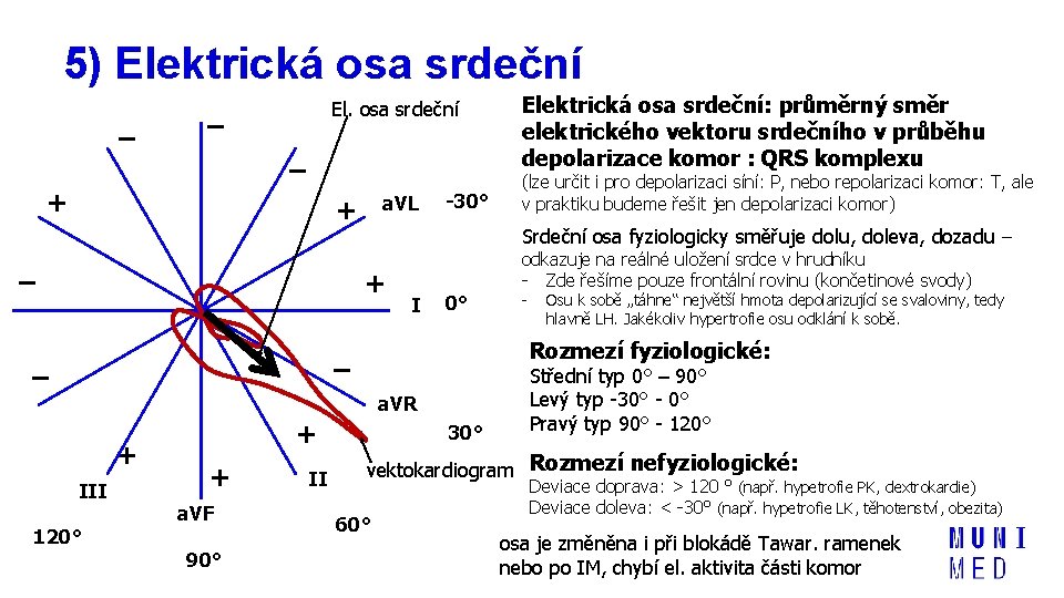 5) Elektrická osa srdeční – El. osa srdeční – – + a. VL +