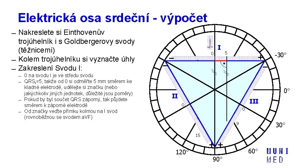 Elektrická osa srdeční - výpočet Nakreslete si Einthovenův trojúhelník i s Goldbergerovy svody (těžnicemi)