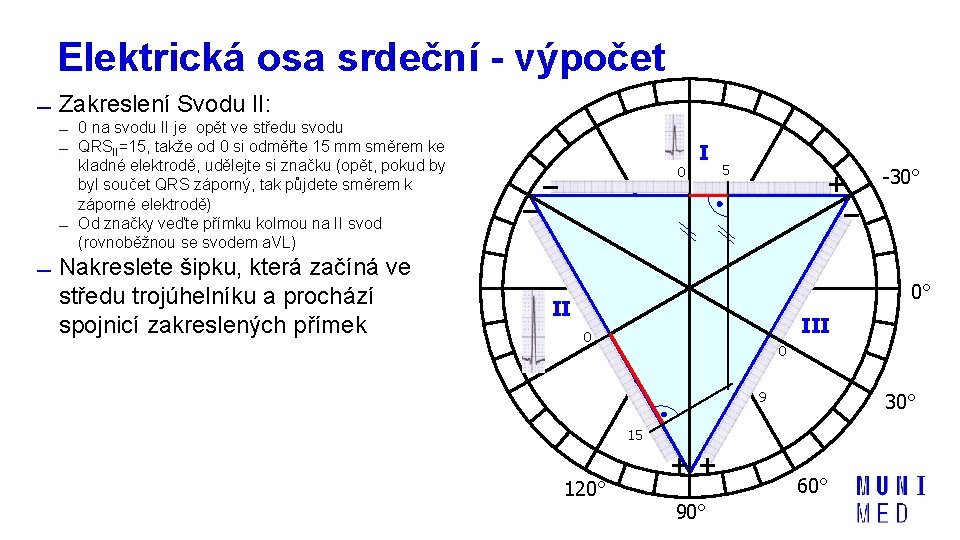 Elektrická osa srdeční - výpočet Zakreslení Svodu II: 0 na svodu II je opět