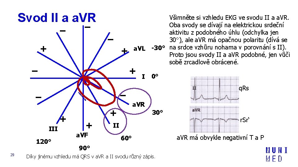 Svod II a a. VR – – – + + – + I 0°