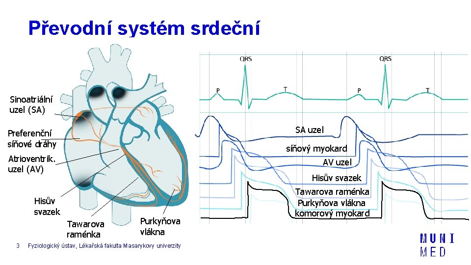 Převodní systém srdeční Sinoatriální uzel (SA) SA uzel Preferenční síňové dráhy síňový myokard Atrioventrik.