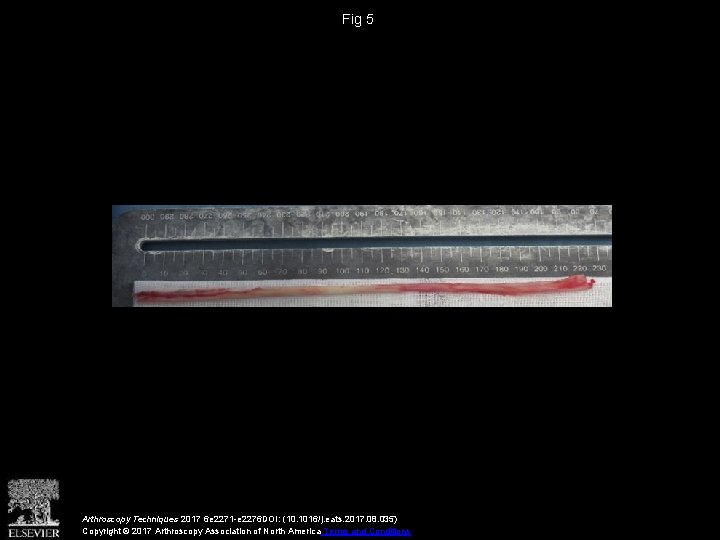Fig 5 Arthroscopy Techniques 2017 6 e 2271 -e 2276 DOI: (10. 1016/j. eats.