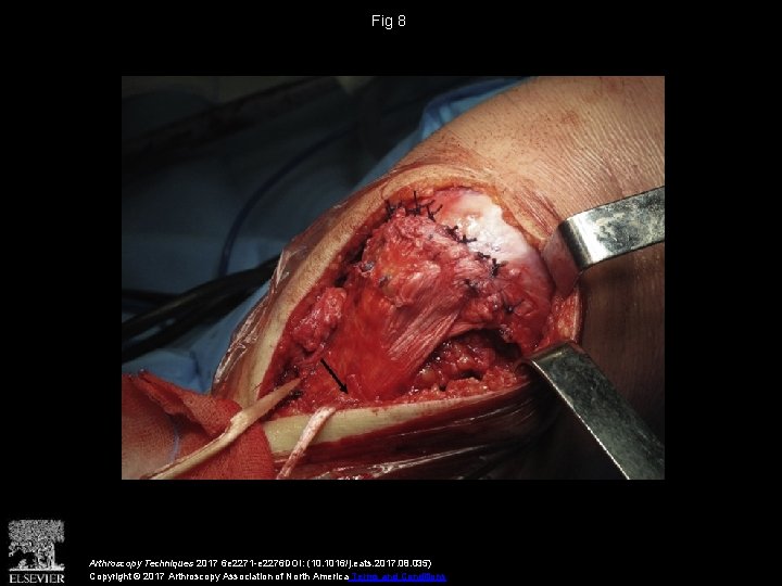Fig 8 Arthroscopy Techniques 2017 6 e 2271 -e 2276 DOI: (10. 1016/j. eats.