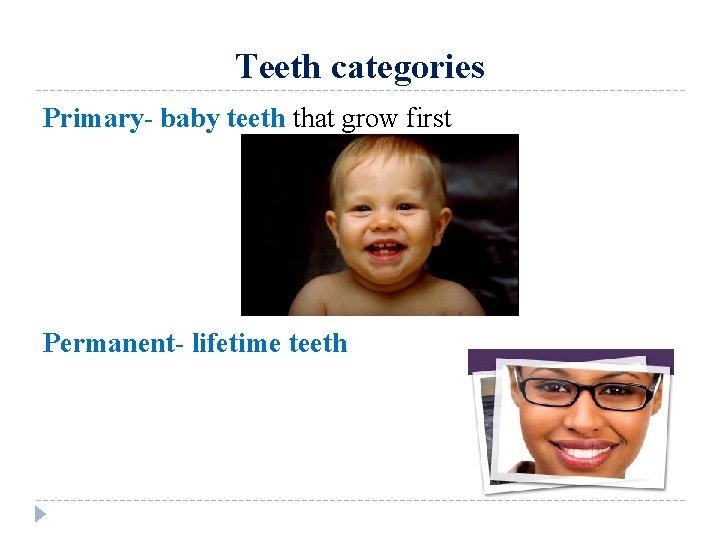 Teeth categories Primary- baby teeth that grow first Permanent- lifetime teeth 