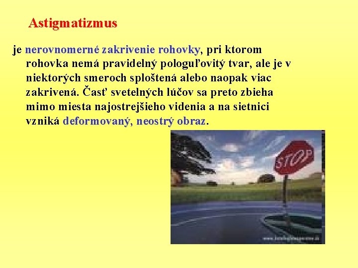 Astigmatizmus je nerovnomerné zakrivenie rohovky, rohovky pri ktorom rohovka nemá pravidelný pologuľovitý tvar, ale