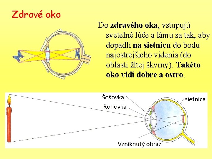 Zdravé oko Do zdravého oka, vstupujú svetelné lúče a lámu sa tak, aby dopadli