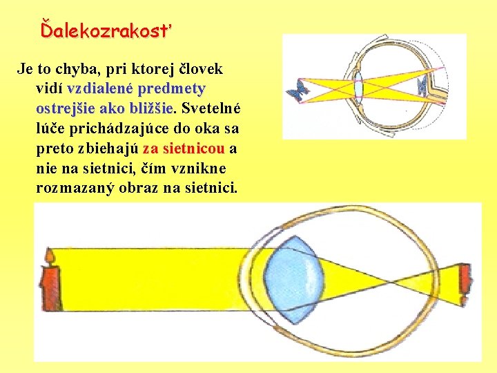 Ďalekozrakosť Je to chyba, pri ktorej človek vidí vzdialené predmety ostrejšie ako bližšie Svetelné