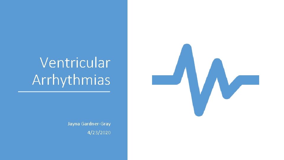 Ventricular Arrhythmias Jayna Gardner-Gray 4/23/2020 