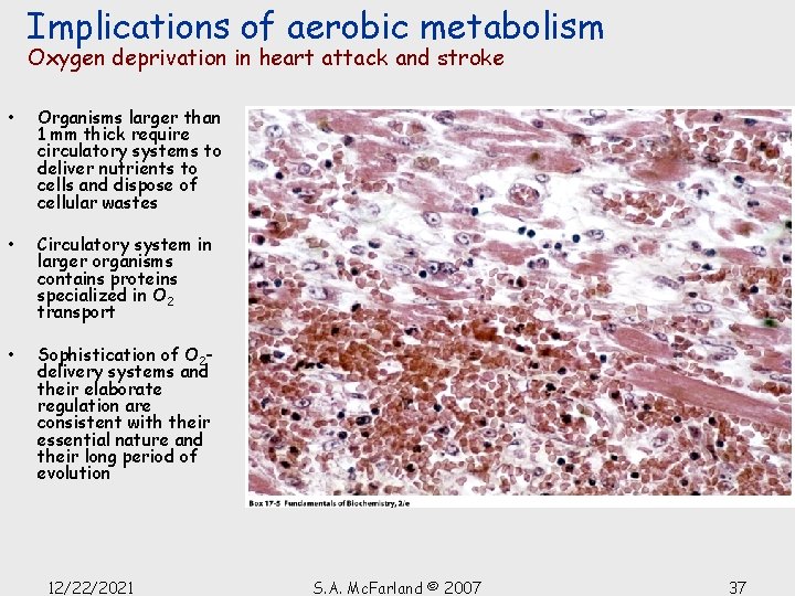 Implications of aerobic metabolism Oxygen deprivation in heart attack and stroke • Organisms larger