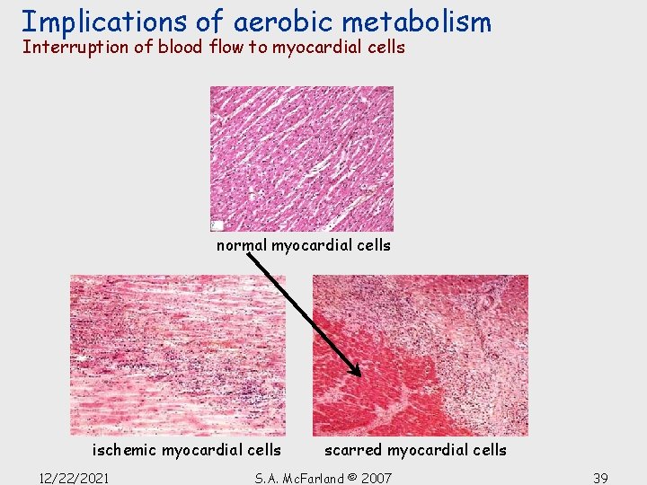 Implications of aerobic metabolism Interruption of blood flow to myocardial cells normal myocardial cells