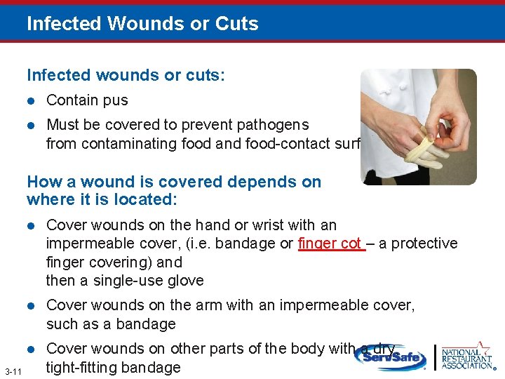 Infected Wounds or Cuts Infected wounds or cuts: l Contain pus l Must be