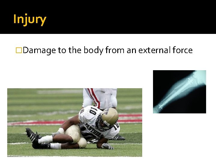 Injury �Damage to the body from an external force Injury �Damage to the body from an external force