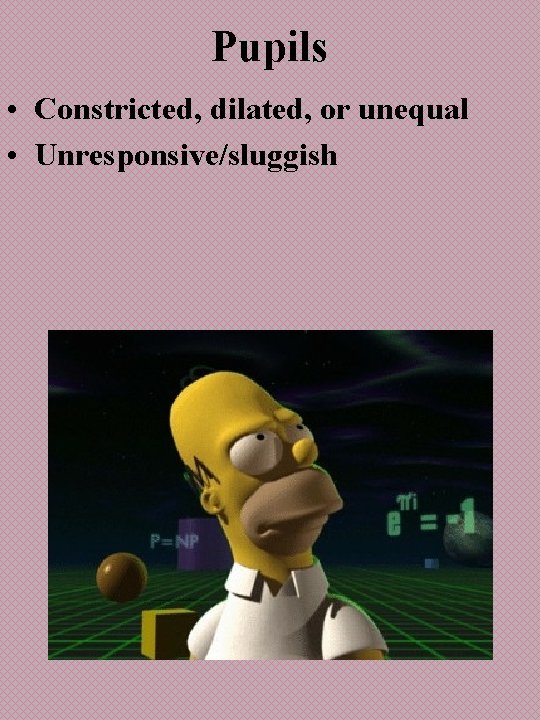 Pupils • Constricted, dilated, or unequal • Unresponsive/sluggish 