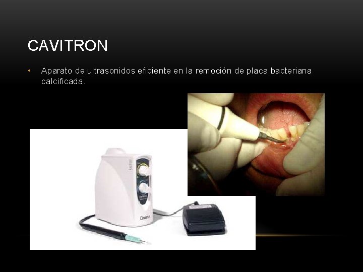 CAVITRON • Aparato de ultrasonidos eficiente en la remoción de placa bacteriana calcificada. 