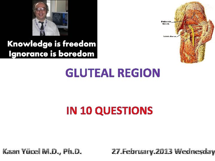 GLUTEAL REGION IN 10 QUESTIONS Kaan Yücel M. D. , Ph. D. 27. February.