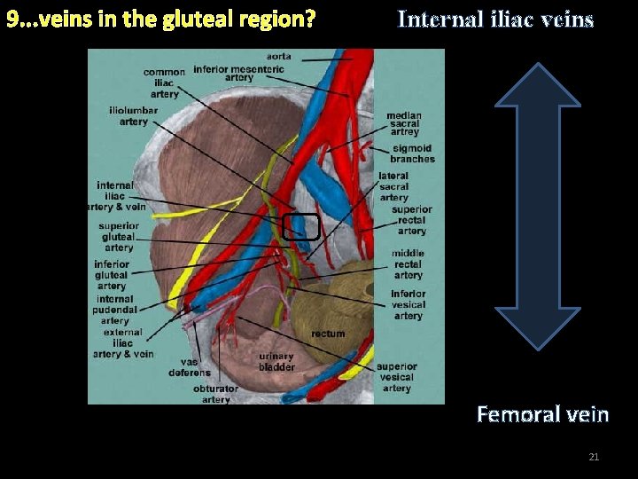 9. . . veins in the gluteal region? Internal iliac veins . Femoral vein