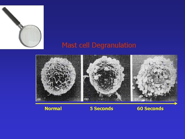 Mast cell Degranulation Normal 5 Seconds 60 Seconds 