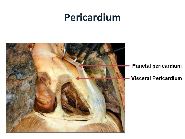 Pericardium Parietal pericardium Visceral Pericardium 
