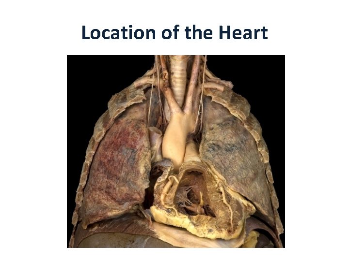 Location of the Heart 